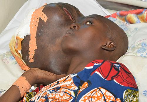 Tchad : Angeline, opérée d'une grave tumeur et sauvée par la Première Dame Tchad : Angeline, opérée d'une grave tumeur et sauvée par la Première Dame