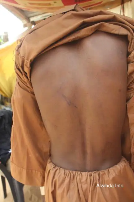 Les tortures infligées sur la victime. Alwihda Info