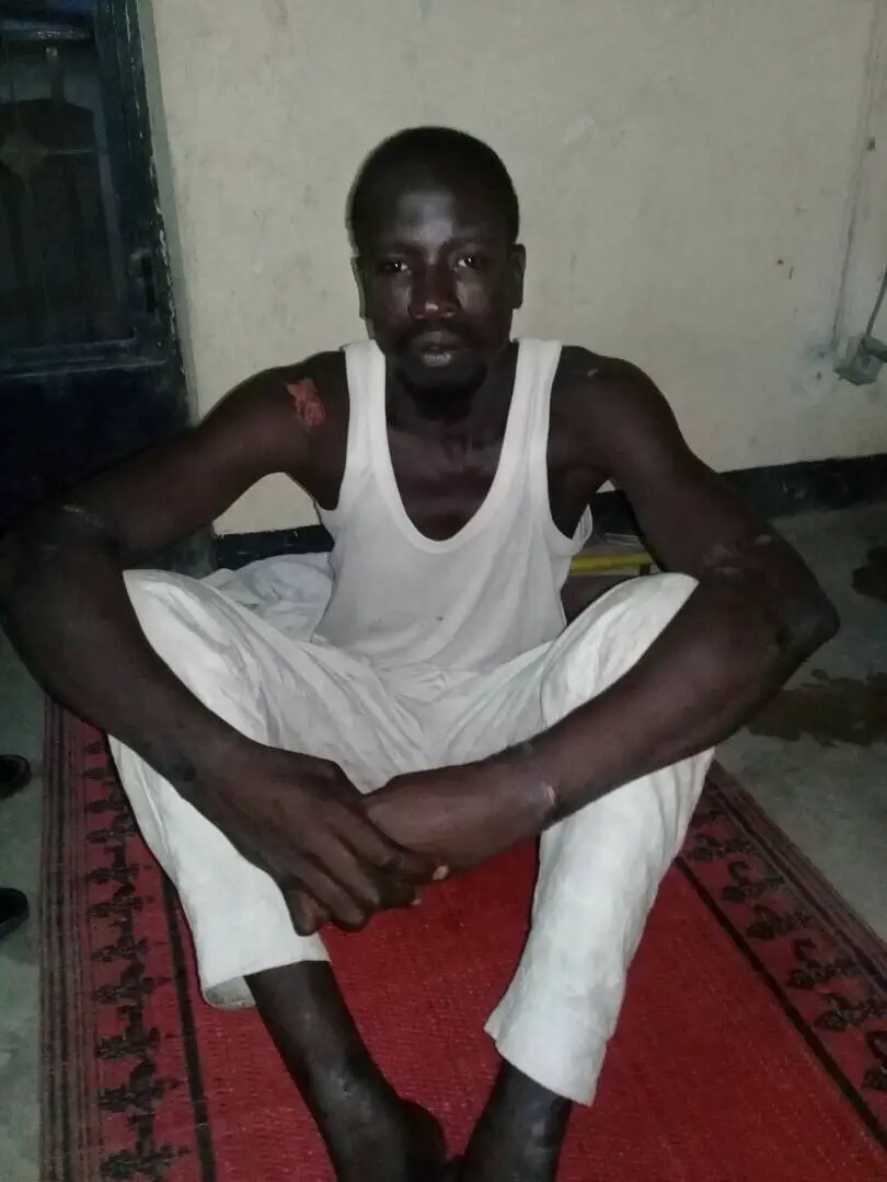 Tchad : Un jeune enlevé, séquestré et torturé par des hommes armés