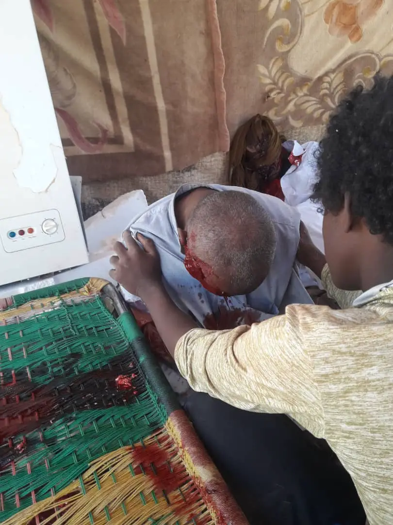 Tchad : bombardements de l’aviation au nord, plusieurs blessés