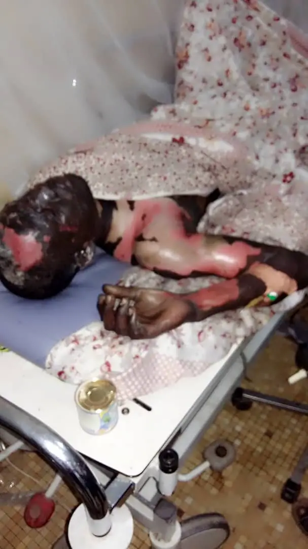 Tchad : le jeune Ali Soumaine Ali est mort brûlé vif à N'Djamena.