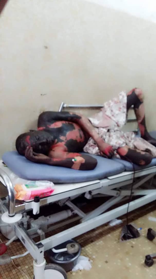 Tchad : le jeune Ali Soumaine Ali est mort brûlé vif à N'Djamena. Tchad : le jeune Ali Soumaine Ali est mort brûlé vif à N'Djamena.