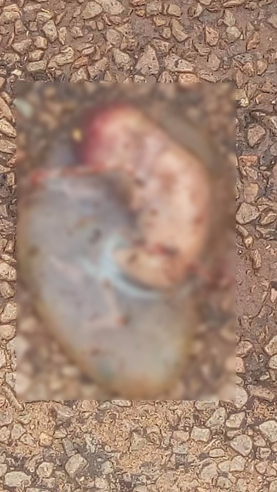 Tchad : une femme jette son fœtus dans la rue à Doba. © Alwihda Info Tchad : une femme jette son fœtus dans la rue à Doba. © Alwihda Info