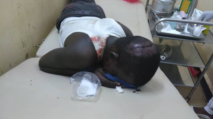 Tchad : deux étudiants blessés dans une bagarre au campus de Toukra Tchad : deux étudiants blessés dans une bagarre au campus de Toukra