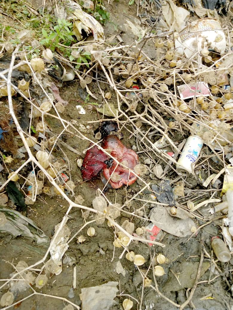 Tchad : une femme toujours recherchée après la découverte d’un fœtus. © DR Tchad : une femme toujours recherchée après la découverte d’un fœtus. © DR