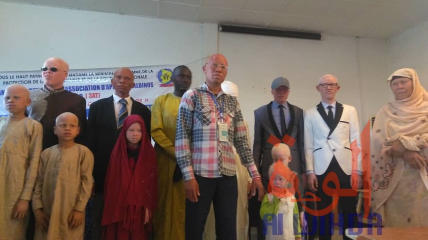Tchad : les albinos demandent une meilleure considération de l'Etat. © Alwihda Info/M.M. Tchad : les albinos demandent une meilleure considération de l'Etat. © Alwihda Info/M.M.