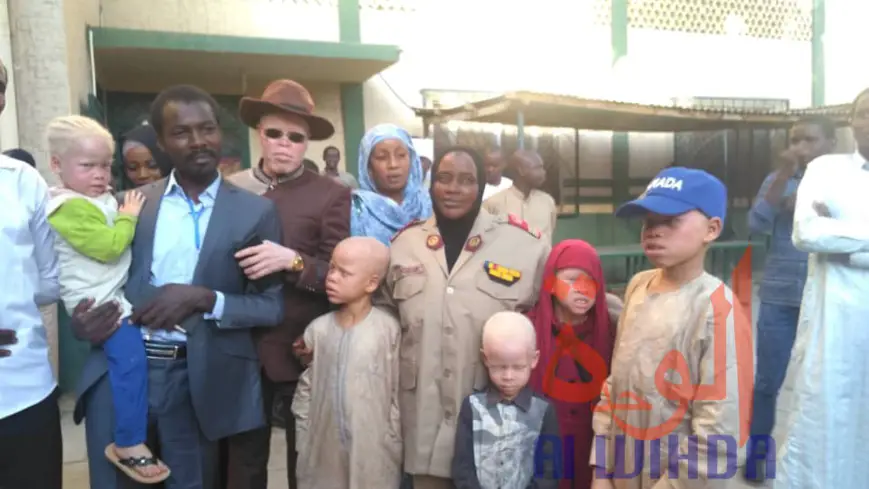 Tchad : les personnes atteintes d'albinisme, entre préjugés et discriminations. © Alwihda Info/M.M.