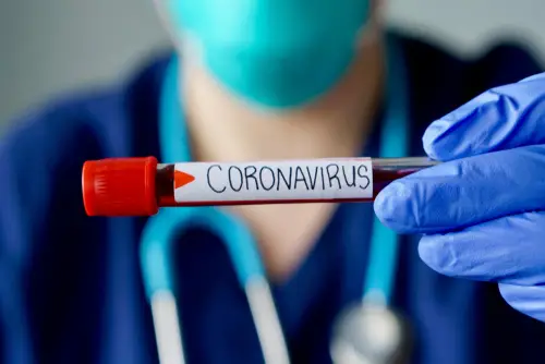 Coronavirus : le Cameroun enregistre un nouveau cas. Illustration. © DR