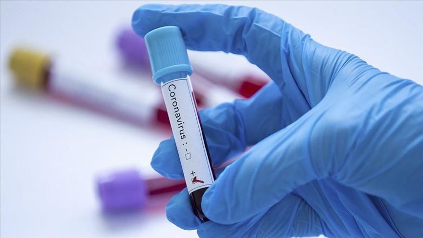 Coronavirus : 7 nouveaux cas au Cameroun, les règles d'hygiène "non respectées". © DR Coronavirus : 7 nouveaux cas au Cameroun, les règles d'hygiène "non respectées". © DR