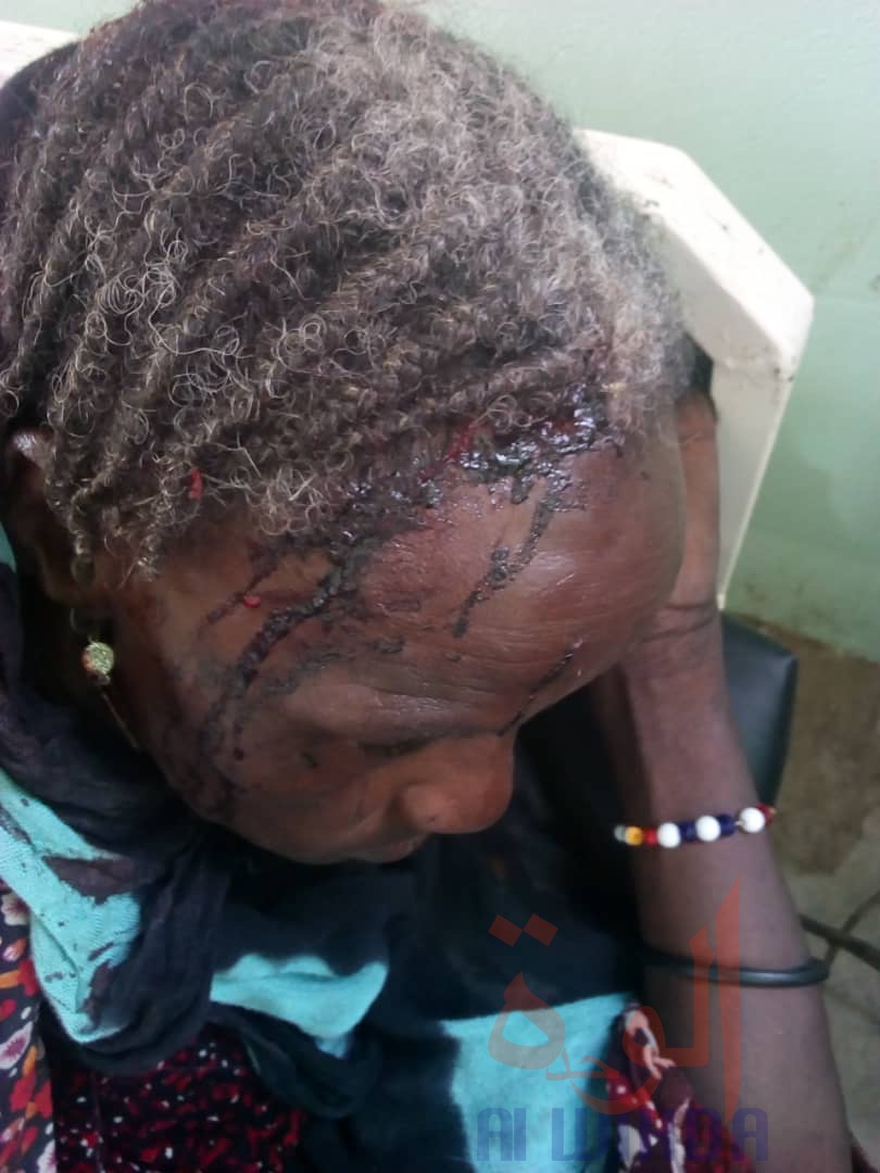 Tchad : un mort et 4 blessés dans un conflit autour d'une mosquée. © Mbainaissem Gédéon Mbeïbadoum/Alwihda Info Tchad : un mort et 4 blessés dans un conflit autour d'une mosquée. © Mbainaissem Gédéon Mbeïbadoum/Alwihda Info