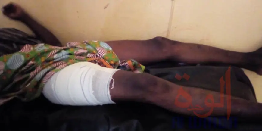 Tchad : des blessés par balles après un incident dans un village. © Foka Mapagne/Alwihda Info