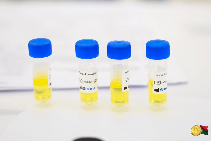 Dépistage du coronavirus à Madagascar. Illustration. © Twitter/Andry Rajoelina Dépistage du coronavirus à Madagascar. Illustration. © Twitter/Andry Rajoelina