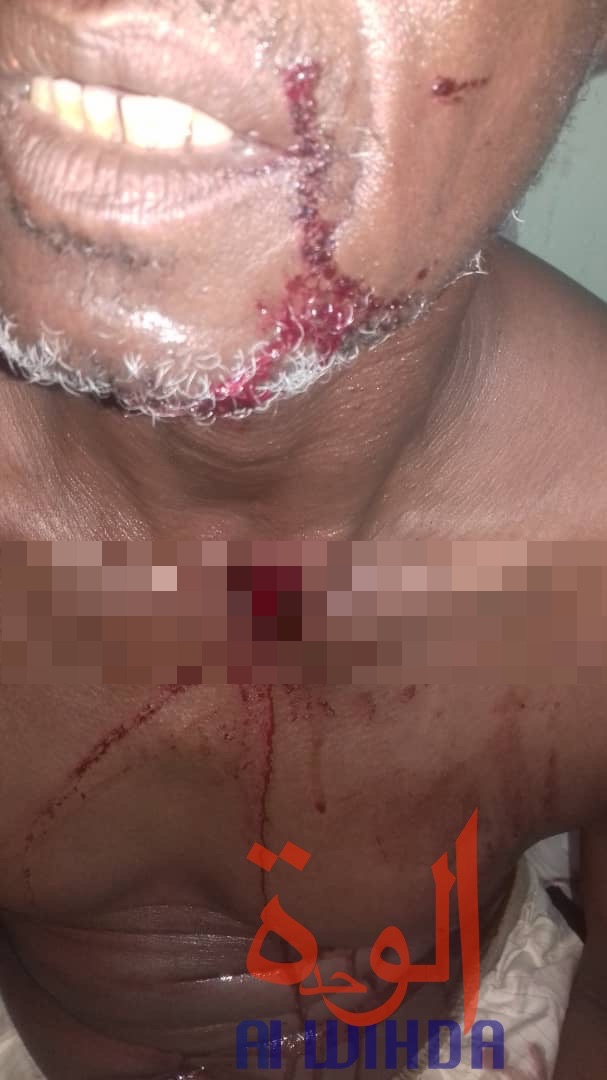 Tchad : le fils d'un préfet tente de tirer sur un chat et atteint un homme à la gorge. © Alwihda Info