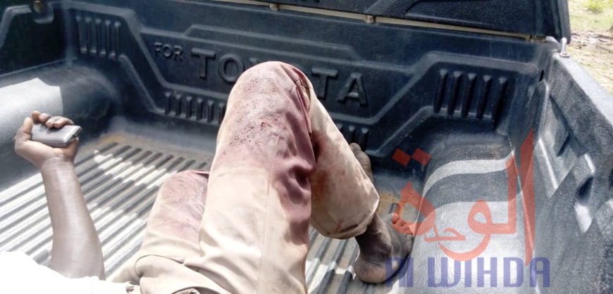 Tchad : 2 morts et 13 blessés dans un conflit près de Laï. © Éric Guedi/Alwihda Info Tchad : 2 morts et 13 blessés dans un conflit près de Laï. © Éric Guedi/Alwihda Info