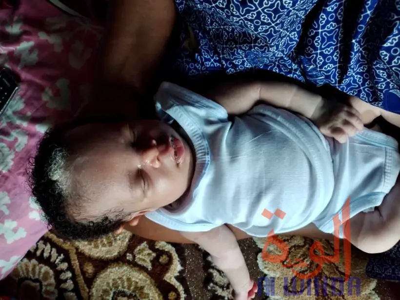 Tchad : un bébé naît avec des cheveux blancs à N'Djamena. © Malick Mahamat/Alwihda Info