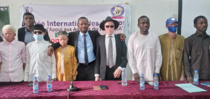 Tchad : comprendre l’albinisme et soutenir les personnes atteintes Tchad : comprendre l’albinisme et soutenir les personnes atteintes