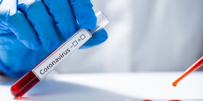 Togo : le gouvernement lance un passeport vaccinal pour les personnes vaccinées contre le Covid-19 Togo : le gouvernement lance un passeport vaccinal pour les personnes vaccinées contre le Covid-19