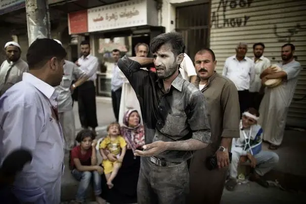 Le survivant d'une frappe aérienne arrive dans un hôpital d'Alep, en Syrie, le 18 septembre 2012 afp.com/Marco Longari