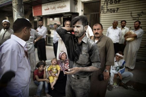 Le survivant d'une frappe aérienne arrive dans un hôpital d'Alep, en Syrie, le 18 septembre 2012 afp.com/Marco Longari Le survivant d'une frappe aérienne arrive dans un hôpital d'Alep, en Syrie, le 18 septembre 2012 afp.com/Marco Longari