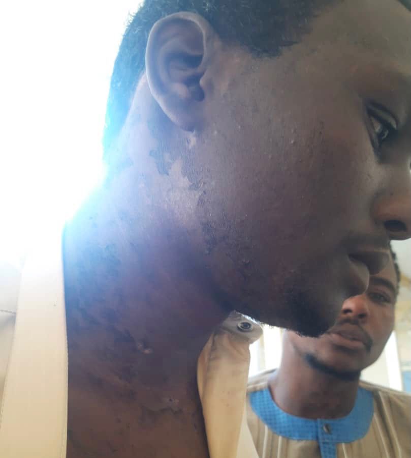 Tchad : la CTDDH s’insurge contre des traitements inhumains d’un chef d’antenne ANS au Salamat Tchad : la CTDDH s’insurge contre des traitements inhumains d’un chef d’antenne ANS au Salamat