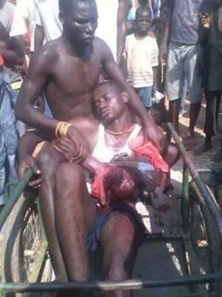 Un homme grièvemment blessé à la machette en Centrafrique. Crédit photo : Sources