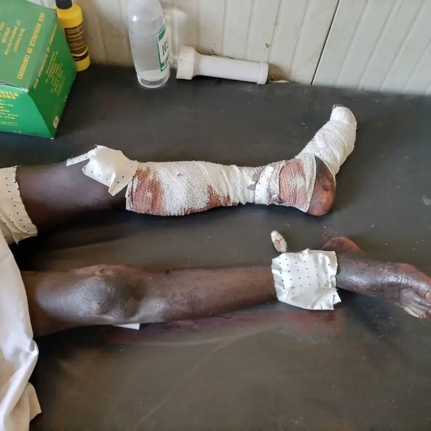 Tchad : une explosion de grenade tue deux enfants au Sila