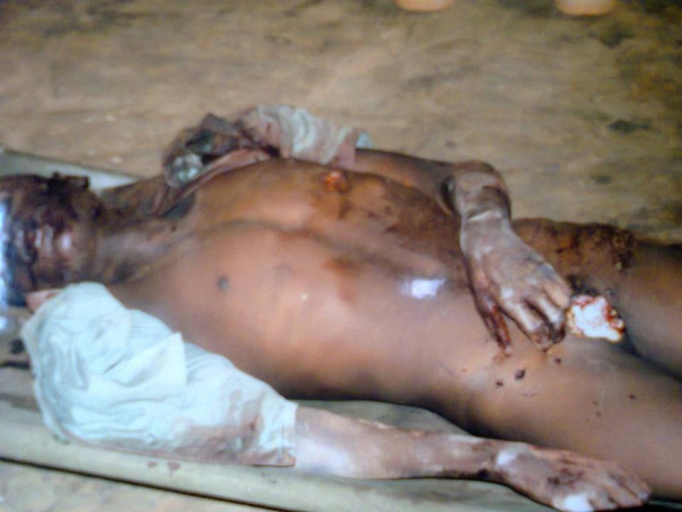 Le corps d'un musulman démembré en Centrafrique, par les Anti-Balaka. Crédit photo : Sources Le corps d'un musulman démembré en Centrafrique, par les Anti-Balaka. Crédit photo : Sources