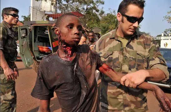 Un musulman grièvement blessé à Bangui. Photo : Sources
