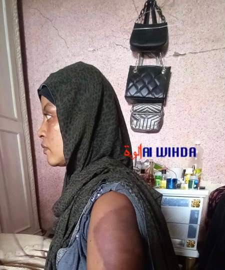 Tchad : une femme affirme avoir été torturée par la sœur du PCMT Tchad : une femme affirme avoir été torturée par la sœur du PCMT