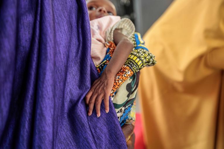 Nigéria : une crise nutritionnelle menace des milliers d'enfants au Nord-Ouest Nigéria : une crise nutritionnelle menace des milliers d'enfants au Nord-Ouest