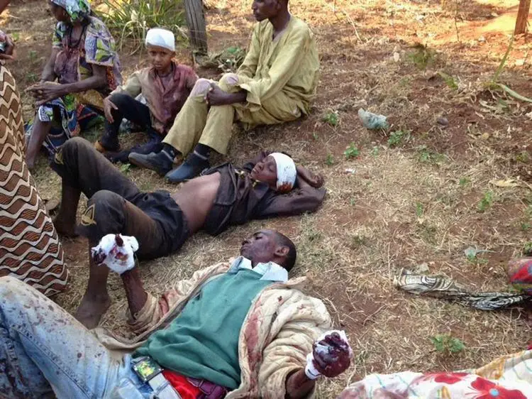 Des musulmans blessés dans le village de Boali, à 95km au nord de Bangui, en Centrafrique. (Photo Maria Malagardis)