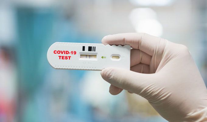 Tchad : désormais un guichet unique des tests Covid-19 pour les voyageurs Tchad : désormais un guichet unique des tests Covid-19 pour les voyageurs