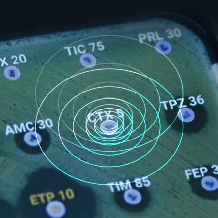 Lutter contre l'antibiorésistance, menace de santé publique Lutter contre l'antibiorésistance, menace de santé publique