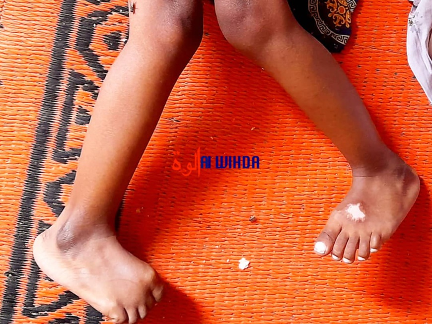 Tchad : un appel à l'aide pour Brahim Moussa, un enfant paralysé de 6 ans Tchad : un appel à l'aide pour Brahim Moussa, un enfant paralysé de 6 ans