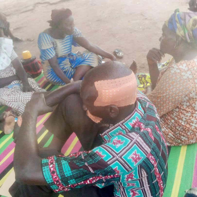 Tchad : violences entre deux familles autour d’un champ au canton Miandoum, 5 blessés