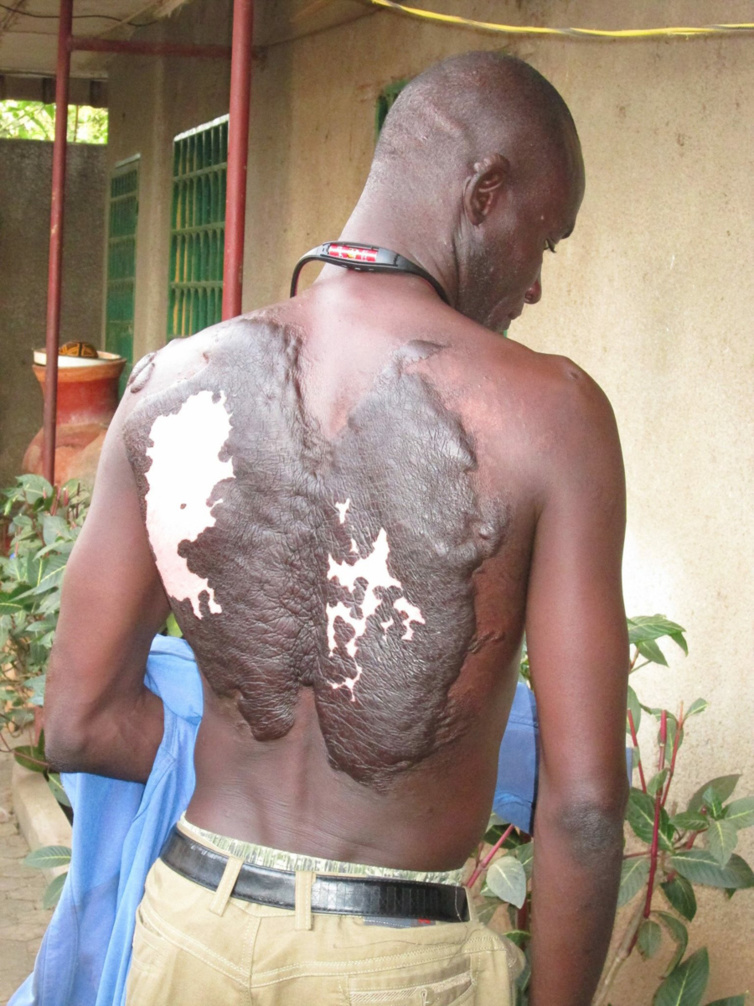 L'étonnant récit d'un jeune tchadien rescapé d'une attaque de Boko Haram L'étonnant récit d'un jeune tchadien rescapé d'une attaque de Boko Haram