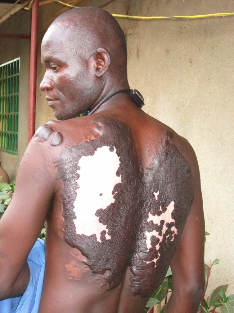 L'étonnant récit d'un jeune tchadien rescapé d'une attaque de Boko Haram L'étonnant récit d'un jeune tchadien rescapé d'une attaque de Boko Haram