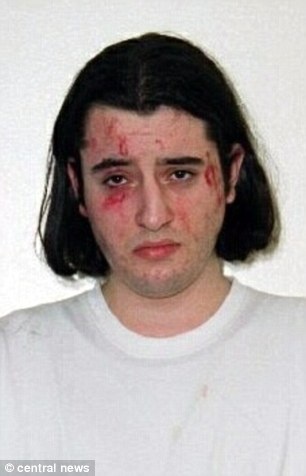 Un marocain victime de graves tortures en Grande Bretagne ? Un marocain victime de graves tortures en Grande Bretagne ?