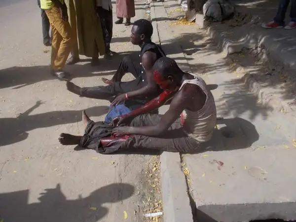 Tchad : les premières images des blessés de l'explosion 