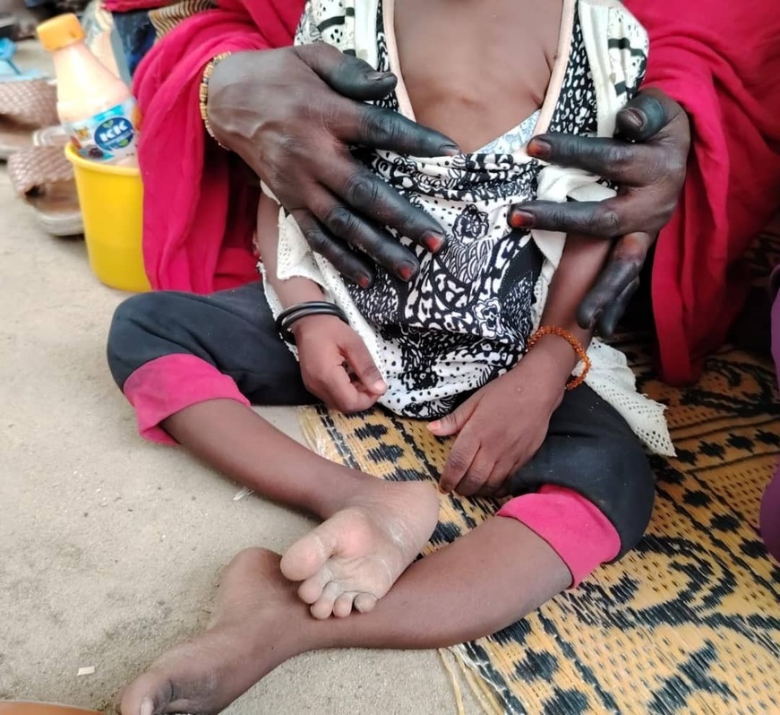 La lutte contre la polio, une priorité vitale pour le Bassin du Lac-Tchad et le Tchad La lutte contre la polio, une priorité vitale pour le Bassin du Lac-Tchad et le Tchad