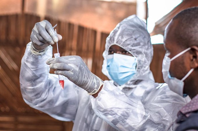 Santé : La RDC confirme ses deux premiers cas de Mpox Clade IIb Santé : La RDC confirme ses deux premiers cas de Mpox Clade IIb