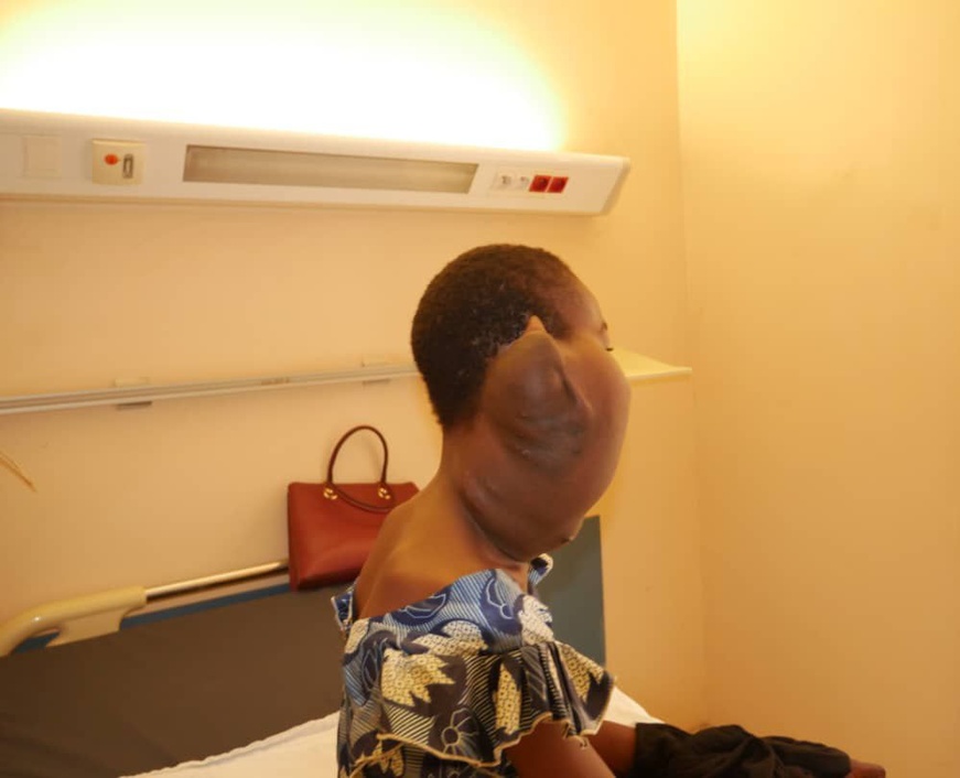 Tchad : une fillette atteinte d’une masse au cou admise au CHU La Renaissance Tchad : une fillette atteinte d’une masse au cou admise au CHU La Renaissance