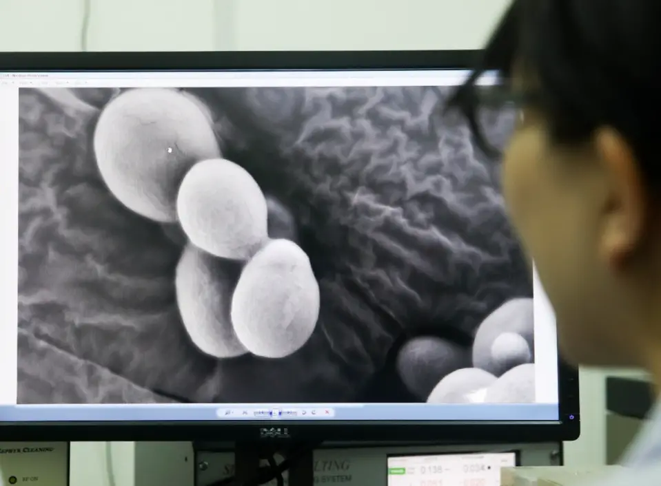 A research team of the Chinese Academy of Sciences creates the world’s first single-chromosome yeast, which is another major breakthrough after the artificial life-prokaryotic mycoplasma. In Aug. 2018, the research was published on internationally renowned multidisciplinary scientific journal Nature. (Photo by Ding Ting, Xinhua)