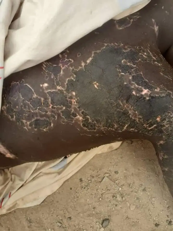 Tchad : des orpailleurs attachés et torturés à mort au Nord