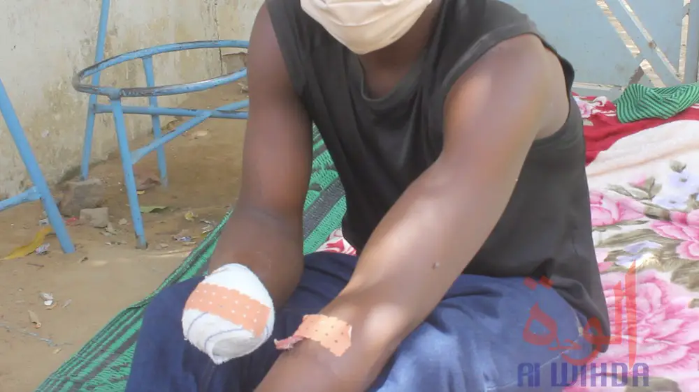 Tchad : Victime d’une explosion de grenade en sauvant les enfants, Djessandjin Augustin perd sa main droite et appelle à l'aide: ©️ Mendig-lembaye Djetoyo Kelvin et Djibrine Haïdar /Alwihda Info