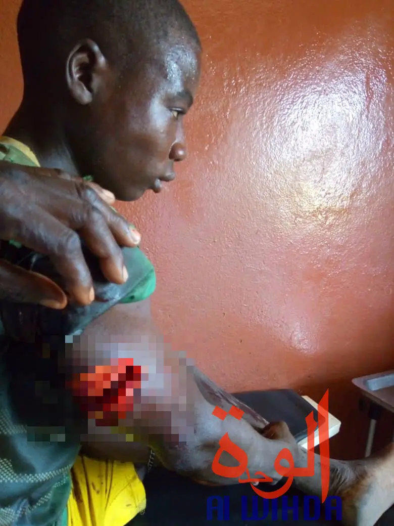Tchad : coups de couteaux et veines coupées, il frôle la mort face à des bouviers