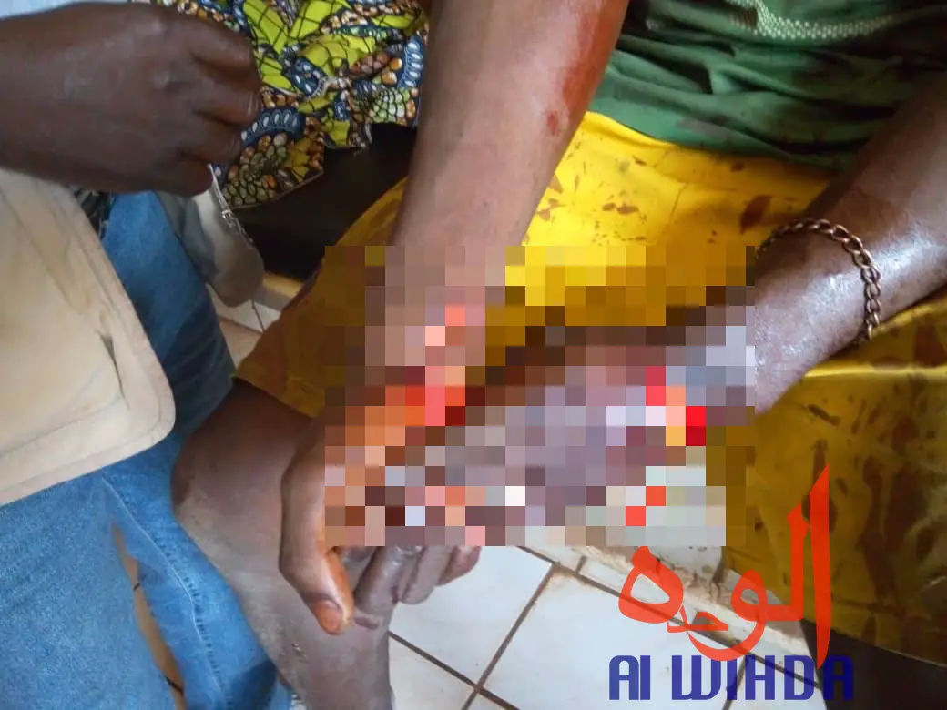 Tchad : coups de couteaux et veines coupées, il frôle la mort face à des bouviers
