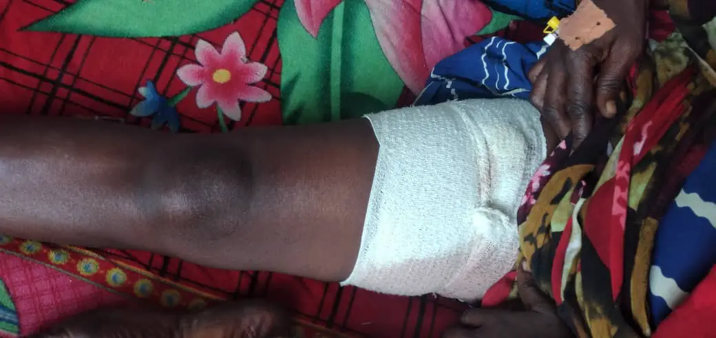 Tchad : un braqueur tire sur sa victime et fait tomber sa carte de militaire en fuyant