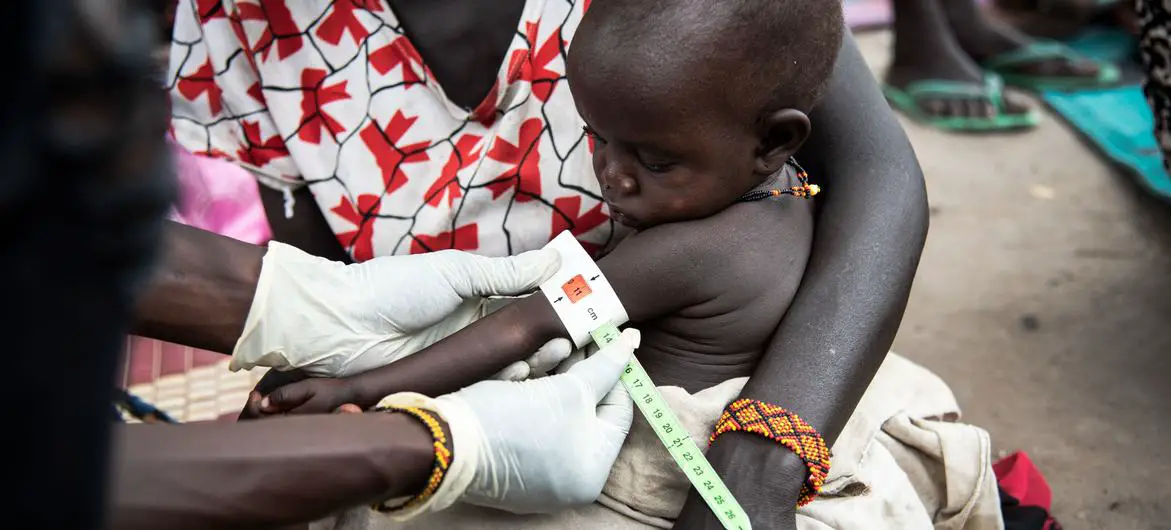 Un enfant fait l'objet d'un dépistage dans une clinique du Soudan du Sud. © UNICEF/Helene Sandbu Ryeng