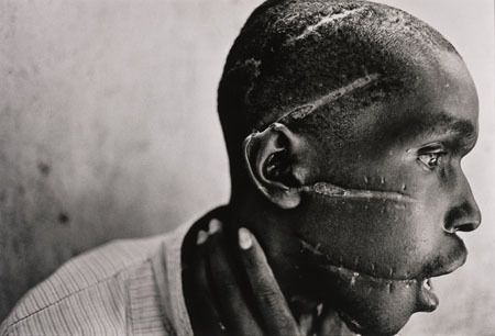 Un rescapé du génocide rwandais. Photo : aregledujeu.org